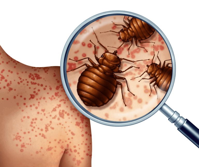 Bed bugs Control services in Ilford London